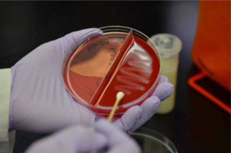hands in white gloves holding a round red petri dish and a cotton swab