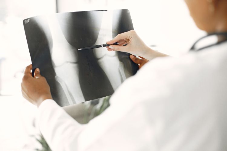 A photo of a doctor looking at an x-ray of someones leg x-ray.