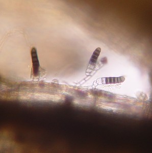 Thielaviopsis basicola conidia on roots