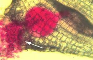 A stained root-knot nematode female with eggs inside a gall 